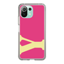 Slim Protection Case［ Original - initial color - Y pink ］