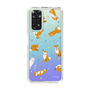 Slim Protection Case［ Shibata-san - All-Over Pattern - Konpeitō ］
