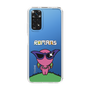 Slim Protection Case［ ROMANs - Beautiful Woman ］
