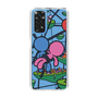 Slim Protection Case［ ROMANs - Firmly Fixed ］