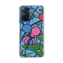 Slim Protection Case［ ROMANs - Firmly Fixed ］