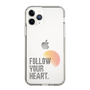 Slim Protection Case［ Original - Dot Overlay - FOLLOW YOUR HEART/A ］