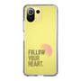 Slim Protection Case［ Original - Dot Overlay - FOLLOW YOUR HEART/A ］