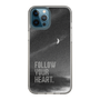 Slim Protection Case［ Original - Dot Overlay - FOLLOW YOUR HEART/B ］