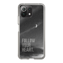 Slim Protection Case［ Original - Dot Overlay - FOLLOW YOUR HEART/B ］