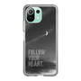 Slim Protection Case［ Original - Dot Overlay - FOLLOW YOUR HEART/B ］
