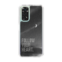 Slim Protection Case［ Original - Dot Overlay - FOLLOW YOUR HEART/B ］