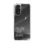 Slim Protection Case［ Original - Dot Overlay - FOLLOW YOUR HEART/B ］