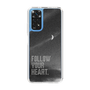 Slim Protection Case［ Original - Dot Overlay - FOLLOW YOUR HEART/B ］
