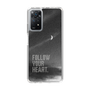 Slim Protection Case［ Original - Dot Overlay - FOLLOW YOUR HEART/B ］