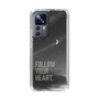 Slim Protection Case［ Original - Dot Overlay - FOLLOW YOUR HEART/B ］