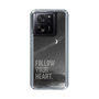 Slim Protection Case［ Original - Dot Overlay - FOLLOW YOUR HEART/B ］