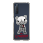 Slim Protection Case［ Gloomy - Skull ］