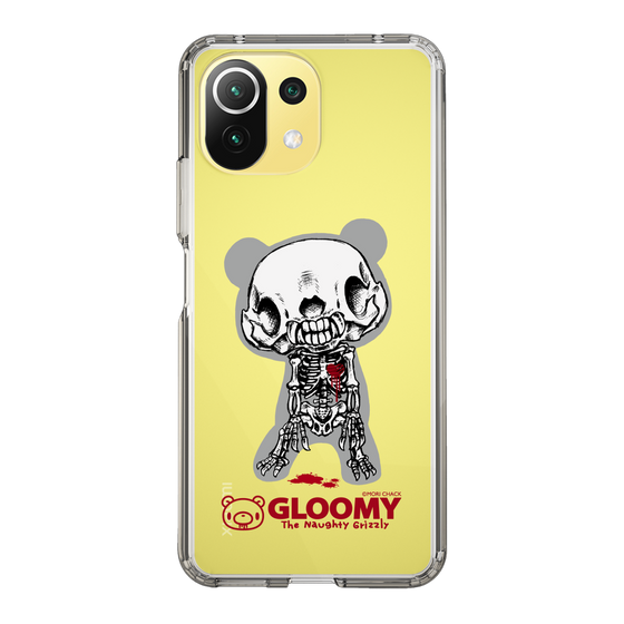 Slim Protection Case［ Gloomy - Skull ］