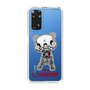 Slim Protection Case［ Gloomy - Skull ］