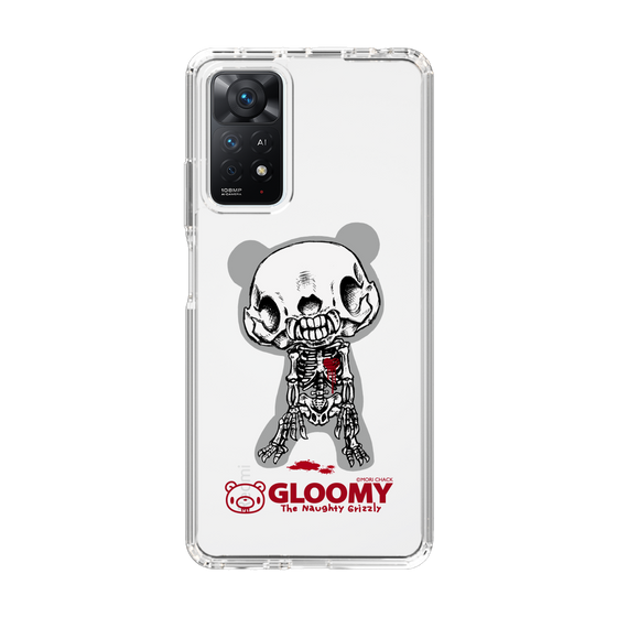 Slim Protection Case［ Gloomy - Skull ］