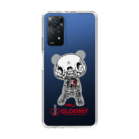 Slim Protection Case［ Gloomy - Skull ］