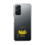 Slim Protection Case［ &UCHINOCO - Rolled-Over Cat ］