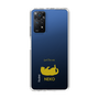 Slim Protection Case［ &UCHINOCO - Rolled-Over Cat ］