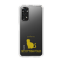 Slim Protection Case［ &UCHINOCO - Scottish Fold 1 ］