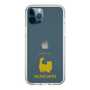 Slim Protection Case［ &UCHINOCO - Munchkin Longhair ］