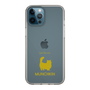 Slim Protection Case［ &UCHINOCO - Munchkin Longhair ］