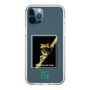 Slim Protection Case［ Green Future Project - Gliding tree frog ］
