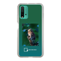 Slim Protection Case［ Green Future Project - Ferruginous Pygmy Owl ］