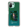 Slim Protection Case［ Green Future Project - Ferruginous Pygmy Owl ］