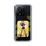 Slim Protection Case［ 【OSHI NO KO】 -  B-KOMACHI - MEMcho ］