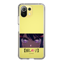 Slim Protection Case［ 【OSHI NO KO】 -  Eyes - Ai ］