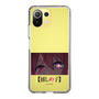Slim Protection Case［ 【OSHI NO KO】 -  Eyes - Ruby ］