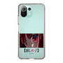 Slim Protection Case［ 【OSHI NO KO】 -  Eyes - Kana Arima ］