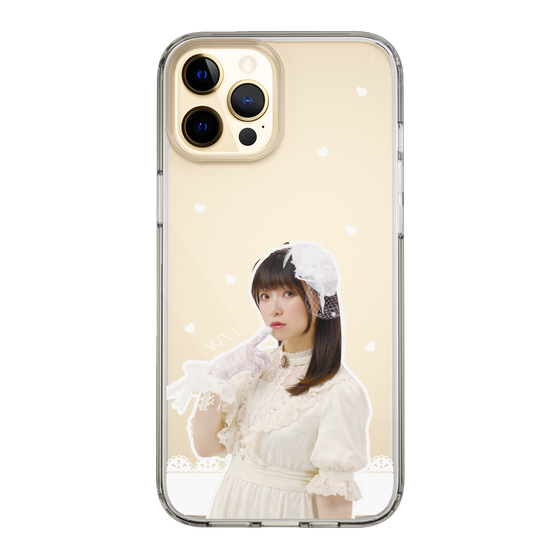 Slim Protection Case［ Akina Homoto - Lace ］
