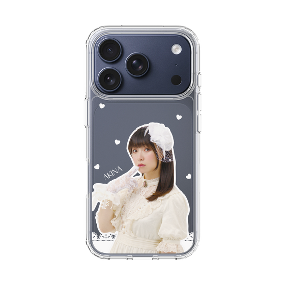 Slim Protection Case［ Akina Homoto - Lace ］