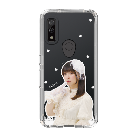 Slim Protection Case［ Akina Homoto - Lace ］