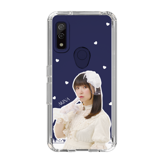 Slim Protection Case［ Akina Homoto - Lace ］