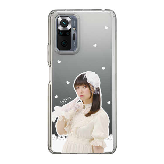 Slim Protection Case［ Akina Homoto - Lace ］