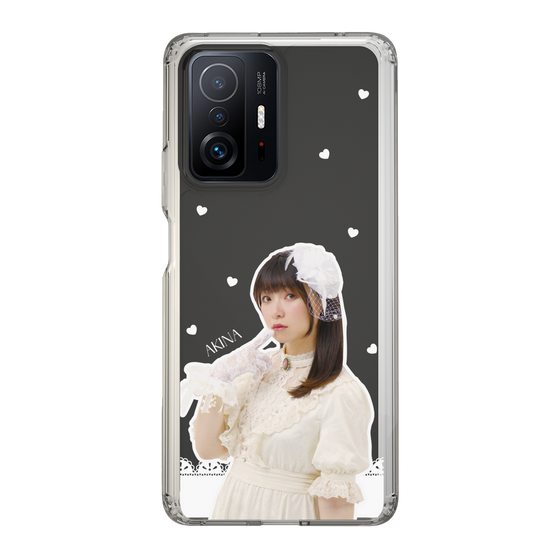 Slim Protection Case［ Akina Homoto - Lace ］