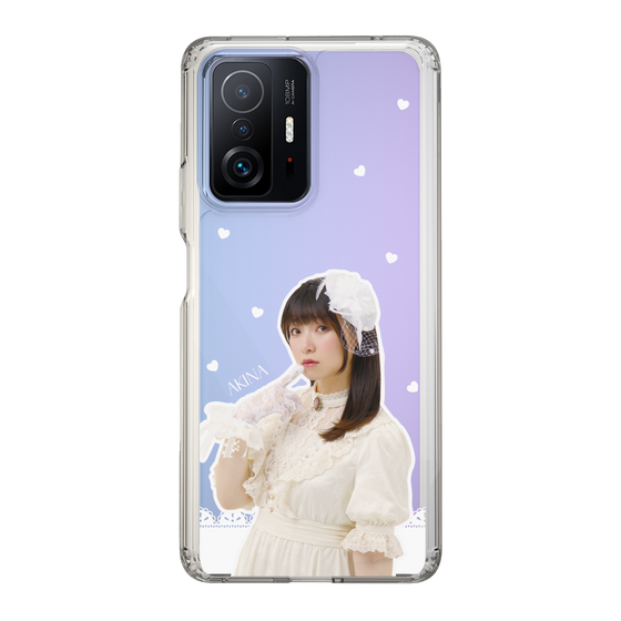 Slim Protection Case［ Akina Homoto - Lace ］