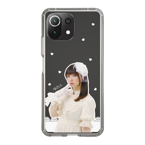 Slim Protection Case［ Akina Homoto - Lace ］