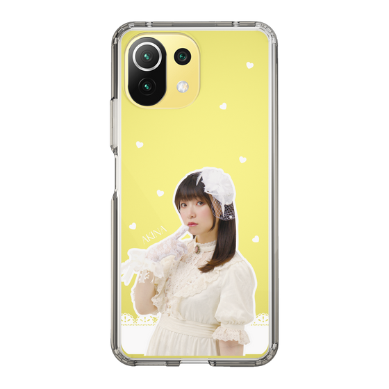 Slim Protection Case［ Akina Homoto - Lace ］