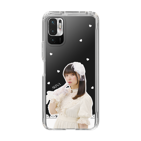Slim Protection Case［ Akina Homoto - Lace ］