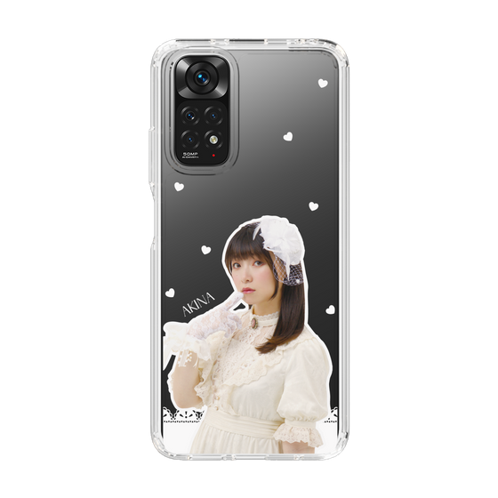 Slim Protection Case［ Akina Homoto - Lace ］
