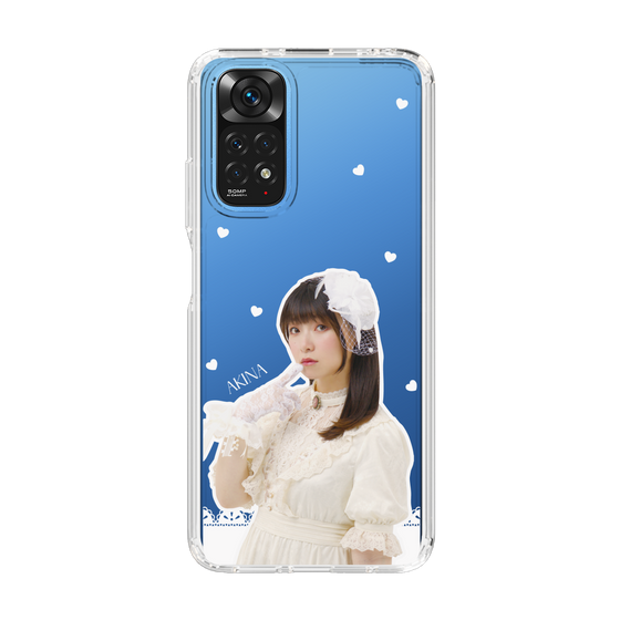 Slim Protection Case［ Akina Homoto - Lace ］