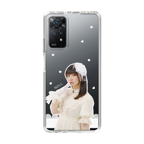 Slim Protection Case［ Akina Homoto - Lace ］