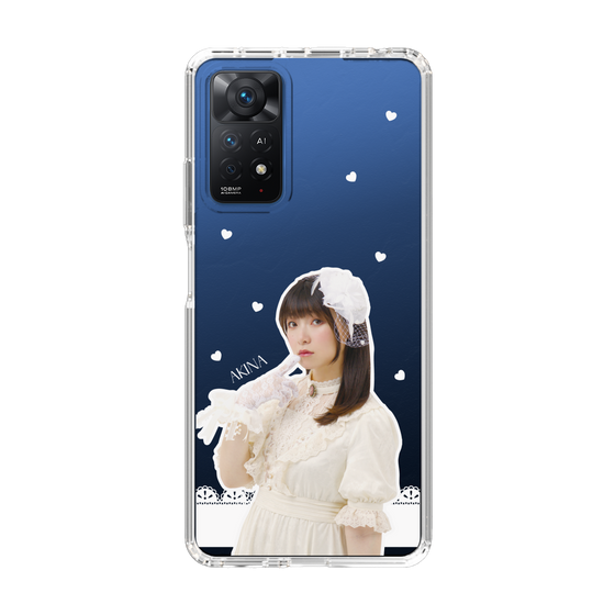 Slim Protection Case［ Akina Homoto - Lace ］