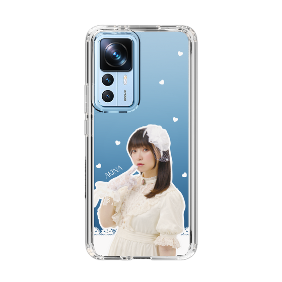 Slim Protection Case［ Akina Homoto - Lace ］