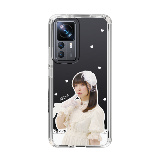Slim Protection Case［ Akina Homoto - Lace ］