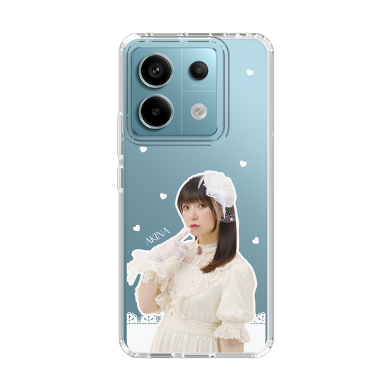 Slim Protection Case［ Akina Homoto - Lace ］